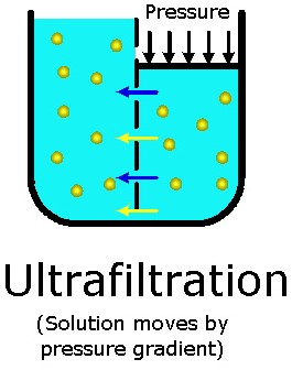 Ultrafiltration